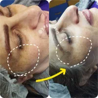 اصلاح ابرو و طراحی ناخن رایگان شد. ماساژ صورت 100|خدمات آرایشگری و زیبایی|اصفهان, پروین|دیوار