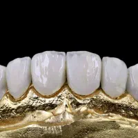 عکاسی و تولید محتوا دندانسازی و دندانپزشکی