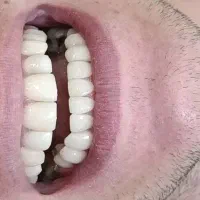 دندان پزشک|خدمات آرایشگری و زیبایی|نورآباد, |دیوار