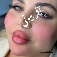 خدمات تخصصی مادلینگ ژل بوتاکس مزوتراپی آنزیم فیلر