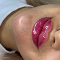 ژل لب بوتاکس فیلر انزیم کامپوزیت دندان|خدمات آرایشگری و زیبایی|مشهد, راهنمایی|دیوار