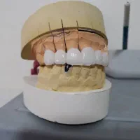 لابراتوار تخصصی دندانسازی آرتمیس|خدمات آرایشگری و زیبایی|اسلام‌شهر, شهرک لاله|دیوار