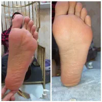 پدیکور  پا|خدمات آرایشگری و زیبایی|اهواز, شریعتی جنوبی|دیوار