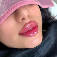 بوتاکس ژل ساکشن چربی جراحی بینی در کلینیک بهنود|خدمات آرایشگری و زیبایی|تبریز, |دیوار