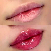 جذب مدل ژل صورت مخصوص فرمدهی و جوانسازی