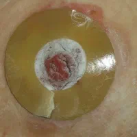 کلینیک زخم و مراقبت پرستاری  تیمان|خدمات آرایشگری و زیبایی|مشهد, جنت|دیوار