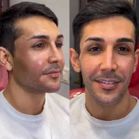 ژل وبوتاکس ،هایفو،پاک کردن تتو، دکتر جابری فر|خدمات آرایشگری و زیبایی|کرمانشاه, |دیوار