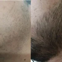 با ریش پرپشت پادشاهی کن