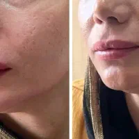 آخرین تخفیف تابستانه کلیه خدمات لاغری و زیبایی|خدمات آرایشگری و زیبایی|کرج, گلشهر|دیوار