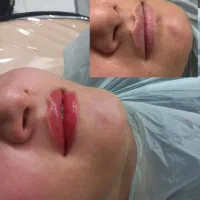 تخفیف یلدایی ۸۸۰ شیدینگ لب تضمین بدون درد|خدمات آرایشگری و زیبایی|دورود, |دیوار