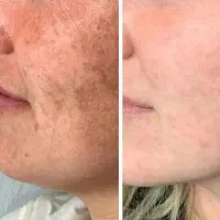 خدمات تخصصی رنگ و کراتین و پوست
