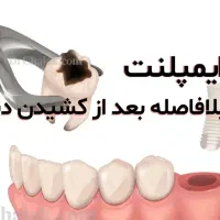 دندانپزشکی/ متخصص جراح فک ولثه /ایمپلنت 9میلیون|خدمات آرایشگری و زیبایی|مشهد, احمدآباد|دیوار