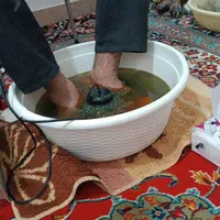 سم زدایی کل بدن با دستگاه|خدمات آرایشگری و زیبایی|زابل, |دیوار