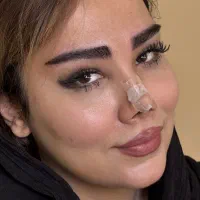 کاشت ابرو فقط12میلیون