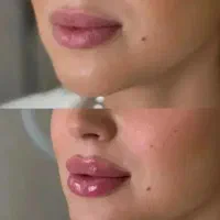 کلینیک تخصصی زیبایی -- حجم و اصلاح (فیلر و بوتاکس)