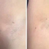 خدمات زیبایی