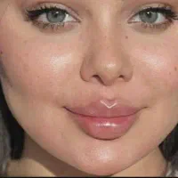 کلینیک زیبایی بوتاکس ژل فیلر بادی نخ لیزر لاغری