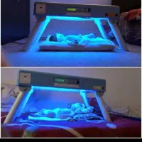 دستگاه  زردی نوزاد .فتوتراپی.اجاره