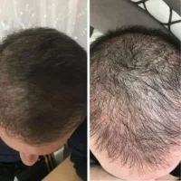 تحولی در چهره ات ایجاد کن