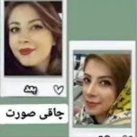 بمب چاقی صورت|خوردنی و آشامیدنی|شیراز, عفیف‌آباد|دیوار