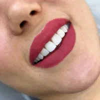 استار دنت