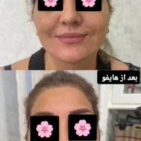 برای دیدن نمونه های کار ما پیغام بگذارید