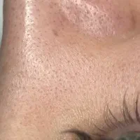 اتاق پوست سما