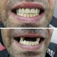 دندانسازی ایده آل|خدمات آرایشگری و زیبایی|لاهیجان, گلستان|دیوار