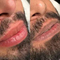 اسکالپ‌سر.کاور(لک‌‌وپیس.تیرگی‌زیرچشم‌و‌لب)