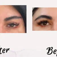 تزریق فیلر بوتاکس و لیفت افتادگی صورت و چشم|خدمات آرایشگری و زیبایی|شیراز, عفیف‌آباد|دیوار
