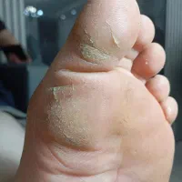 کفسابی پدیکور پارافین تراپی  روشن سازی دست محمدیه