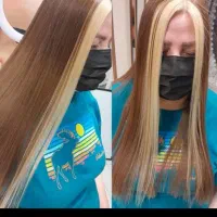 مدل برای فیبروز و خاویار تراپی|خدمات آرایشگری و زیبایی|اردبیل, |دیوار