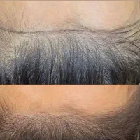 انجام کلیه خدمات آرایش دائم