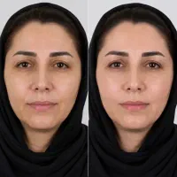 کلینیک آدونیس