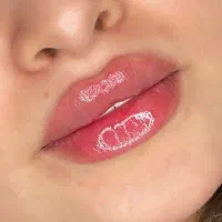 تزریق ژل لب وکانتورینگ(+بوتاکس رایگان|خدمات آرایشگری و زیبایی|کرمانشاه, |دیوار