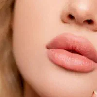 مدل تزریق لب کاملا رایگان