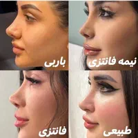 تخفیف عمل جراحی بینی لیفت لیپو ابدو کاشت ابرو مو