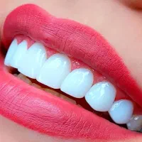 ایمپلنت،کامپوزیت دندان، روکش،عصب کشی،لمینت