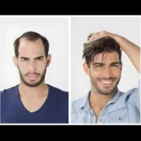 خدا حافظی با بی مویی|خدمات آرایشگری و زیبایی|فردیس, فردیس|دیوار