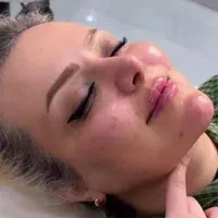 جشنواره باور نکردنی ویژه. ژل و بوتاکس.فیلر مزو ژل|خدمات آرایشگری و زیبایی|شیراز, سینما سعدی|دیوار