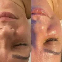 فیشیال تخصصی و درمان مشکلات پوستی|خدمات آرایشگری و زیبایی|تهران, بهاران|دیوار