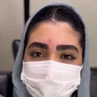 اصلاح تخصصی صورت و ابرو  بدون درد و جوش|آرایشگاه و سالن‌های زیبایی|صدرا-فارس, فاز ۱|دیوار