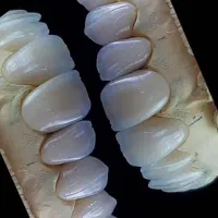 خدمات درمانی دندان پزشکی|خدمات آرایشگری و زیبایی|قم, چهار مردان|دیوار