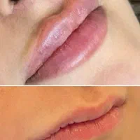 تخفیفات زیبایی و عملهای جراحی|خدمات آرایشگری و زیبایی|دوگنبدان, |دیوار