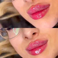 کلینیک ژل لب روسی و بوتاکس و آنزیم فیلر مطب پزشک|خدمات آرایشگری و زیبایی|کرج, گوهردشت|دیوار