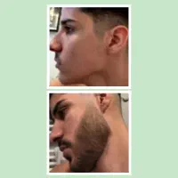 پسر بدون ریش کنسله