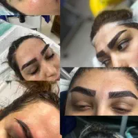 کاشت ابرو فقط 13میلیون