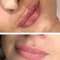 کلینیک زیبایی هیدی