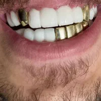 دندان پزشکی (تعرفه دولتی)|خدمات زیبایی و سلامت|تهران, شهرک ابوذر|دیوار