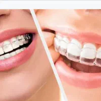 دندانپزشکی تخصصی ارتودنسی(مرتب کردن دندان ها) قسطی|خدمات آرایشگری و زیبایی|اهواز, شهرک حفاری|دیوار